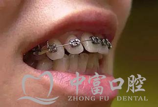 牙齿不齐